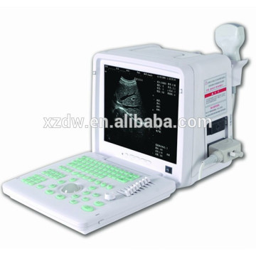 DW360 12''LED screen portable medical ultrasound device & sonography scanner for sale